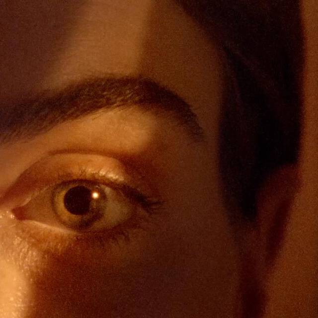 Skin Type Image